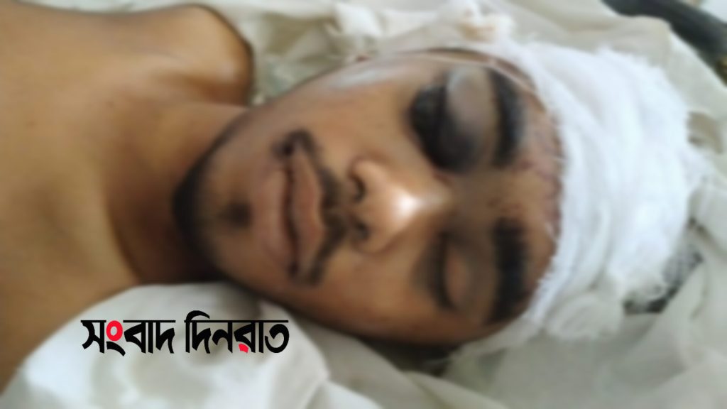 বগুড়ায় চাচার হাতে ভাতিজা খুন